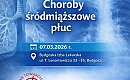 Głęboki oddech w Bydgoszczy. W sobotę rozpoczną się III Interdyscyplinarne Dni Pulmonologiczne