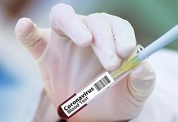 3,5 tysiąca  szczepionek przeciw COVID-19 dla szpitali w kujawsko-pomorskim