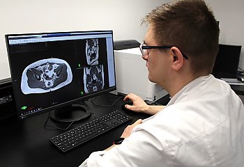 Bydgoskie Centrum Onkologii zgarnia rekordowy grant! 74 miliony na walkę z jednym z najgroźniejszych nowotworów mózgu