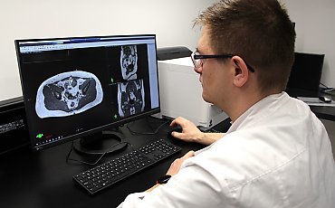 Bydgoskie Centrum Onkologii zgarnia rekordowy grant! 74 miliony na walkę z jednym z najgroźniejszych nowotworów mózgu