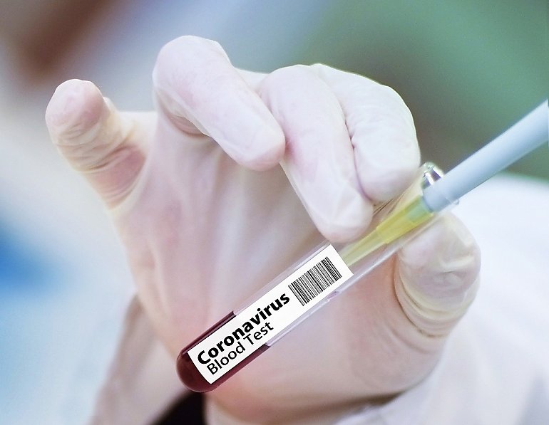 Prawie 600 nowych przypadków koronawirusa. 28 w województwie [RAPORT Z 17 SIERPNIA]