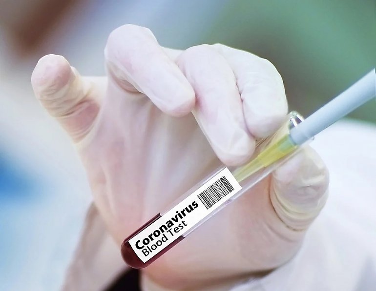 3,5 tysiąca  szczepionek przeciw COVID-19 dla szpitali w kujawsko-pomorskim